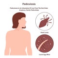 Pediculosis concept. Child with parasites, lice invasion. Hair louse