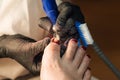 Pedicure removing old coating. Chiropody