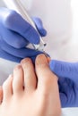 Peeling feet with special electric device.Professional hardware pedicure using electric machine.Patient on medical Royalty Free Stock Photo