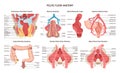 Pelvic floor anatomy. Rectum and colone blood supply, muscular