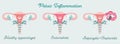 Women health - Pelvic Inflammation. Anatomical scheme of Endometritis, Oophoritis, Salpingitis. Gynecological Problems