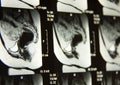 Pelvic MRI