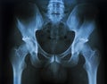Pelvis Royalty Free Stock Photo