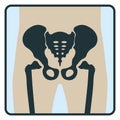 Pelvis bone, x-ray concept icon, roentgen human body image isolated on white, flat vector illustration. Skeleton part of man Royalty Free Stock Photo