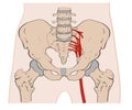 The pelvis consists of the sacrum, the coccyx,the ischium, the ilium, and the pubis.
