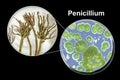 Penicillium mold fungi, illustration and photo of colony grown on nutrient medium