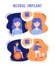 Neural implants flat vector illustration medical concept Royalty Free Stock Photo