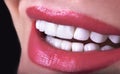 Perfect Close Up White beautiful Veneers Teeth bleaching crowns whitening young lady smiling, Sensual female plump Lips woman smil Royalty Free Stock Photo