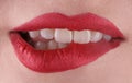 Perfect healthy teeth beautiful wide smile bleaching procedure whitening of young smiling attractive sexy red lips woman. Dental Royalty Free Stock Photo