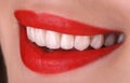 Perfect healthy teeth beautiful wide smile bleaching procedure whitening of young smiling attractive sexy red lips woman. Dental Royalty Free Stock Photo