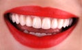 Perfect healthy teeth beautiful wide smile bleaching procedure whitening of young smiling attractive sexy red lips woman. Dental Royalty Free Stock Photo