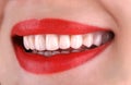 Perfect healthy teeth beautiful wide smile bleaching procedure whitening of young smiling attractive sexy red lips woman. Dental Royalty Free Stock Photo