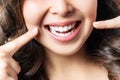 Perfect healthy teeth smile of a young woman. Teeth whitening. Dental clinic patient. Image symbolizes oral care