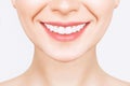 Perfect healthy teeth smile of a young woman. Teeth whitening. Dental clinic patient. Image symbolizes oral care