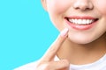 Perfect healthy teeth smile of a young woman. Teeth whitening. Dental clinic patient. Image symbolizes oral care