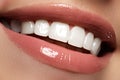 Perfect smile before and after bleaching. Dental care and whiten Royalty Free Stock Photo