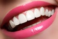 Perfect smile before and after bleaching. Dental care and whitening teeth. Smile with white healthy teeth. Healthy woman teeth Royalty Free Stock Photo