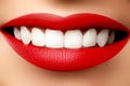 Perfect smile after bleaching. Dental care and whitening teeth. Royalty Free Stock Photo