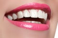 Perfect smile after bleaching. Dental care and whitening teeth. Woman smile with great teeth. Close-up of smile with white healthy