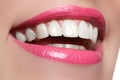 Perfect smile after bleaching. Dental care and whitening teeth. Woman smile with great teeth. Close-up of smile with white healthy Royalty Free Stock Photo