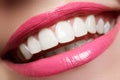 Perfect smile after bleaching. Dental care and whitening teeth. Woman smile with great teeth. Close-up of smile with white healthy Royalty Free Stock Photo