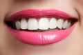 Perfect smile after bleaching. Dental care and whitening teeth. Woman smile with great teeth. Close-up of smile with white healthy Royalty Free Stock Photo