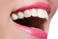 Perfect smile after bleaching. Dental care and whitening teeth. Woman smile with great teeth. Close-up of smile with white healthy Royalty Free Stock Photo