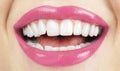 Perfect smile . Healthy tooth. Royalty Free Stock Photo