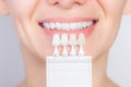 Perfect white smile with shade guide bleach color tooth dental whitening, bleaching, quality control and color check at