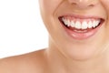 Perfectly white. Closeup shot of a young womans toothy smile against a white background. Royalty Free Stock Photo