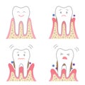 Periodontal desease