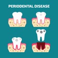 Periodontal disease icons set. Vector illustration