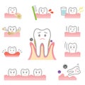 Periodontal disease Royalty Free Stock Photo