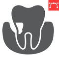 Periodontitis glyph icon, dental and stomatolgy, periodontal tooth sign vector graphics, editable stroke solid icon, eps