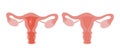 Periods. Menstruation. Modern vector cartoon uterus illusration. Royalty Free Stock Photo