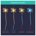 Peripheral neuropathy. Explain illustration for The Peripheral neuropathy