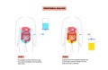 Peritoneal dialysis concept