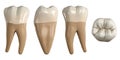 Permanent lower first molar tooth. 3D illustration of the anatomy of the mandibular first molar tooth in buccal, proximal, lingual Royalty Free Stock Photo