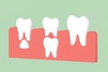 Permanent tooth located below primary tooth