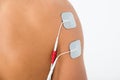 Person with electrodes on shoulder Royalty Free Stock Photo