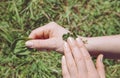 Person hand holding and healing wound with antibacterial plant mixture of Plantago major broadleaf plantain white man`s foot.