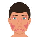 Person with lacrimal and salivary glands