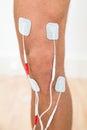 Person leg with electrodes on knee Royalty Free Stock Photo