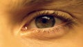 Person suffering dry eye syndrome, eye strain, ophthalmology, extreme close-up Royalty Free Stock Photo