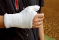 person with the thumb and wrist plastered after the fracture of
