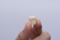 Fingers holding extracted wisdom tooth