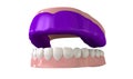 Gum Guard Fitted On Open False Teeth Royalty Free Stock Photo