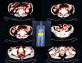 Pet/ct level of intestines Royalty Free Stock Photo