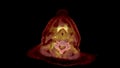 PET CT Scan fusion image It provides detailed images by merging