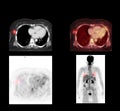 PET CT Scan image of whole body . Royalty Free Stock Photo